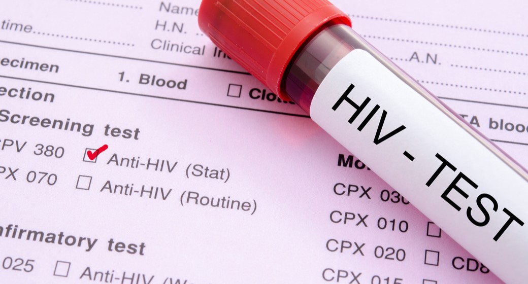 What To Know About HIV Discrimination In The Workplace